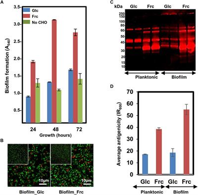 Growth Mode and Carbon Source Impact the Surfaceome Dynamics of Lactobacillus rhamnosus GG